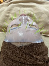 サクラ(Sakura)/美肌潤いコース★鍼×パック