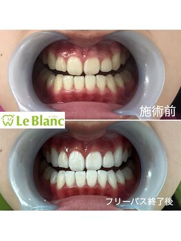 ルブラン 奈良店(Le Blanc)/歯のお色大丈夫ですか??
