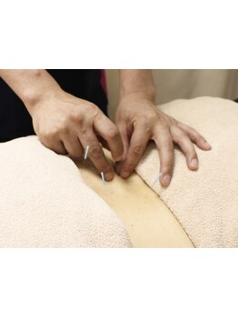 鍼灸施術を受けたい