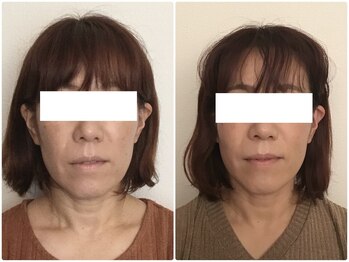 ウェリナ平和堂長久手院/小顔矯正/骨盤矯正/美脚サロン