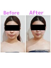 ルル(Ruru)/韓国コルギ/10回目