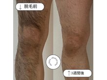 ステキラ 大倉山(Stekira)の雰囲気（全身脱毛コースのあるサロン、痛みが少なく１回目から効果あり◎）