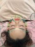 【全員/美容鍼×整体】100本美容鍼×ポキポキ整体(電気鍼+全身骨格矯正）