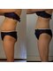 ヨサパーク ミリナ(YOSAPARK Mirina)の写真/理想の体へ☆座っているだけで見た目痩せ！全てがかなう痩身美肌を短期集中で！