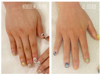 キレイテ 上野店/40代/2回目【ハンドケア稲荷町】