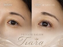 ティアラ(Tiara)