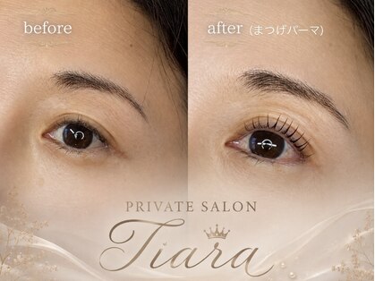 ティアラ(Tiara)の写真