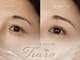 ティアラ(Tiara)の写真