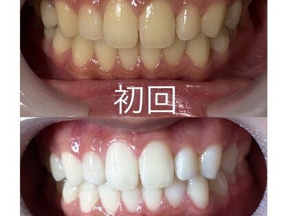 アイネイルサロン(i nail salon)の写真
