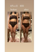 灯香庵 玉響(たまゆら)/【漢本草アロマ】beforeafter