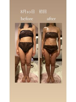 灯香庵 玉響(たまゆら)/【漢本草アロマ】beforeafter