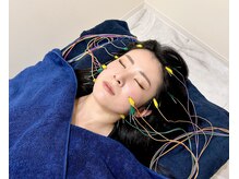 グリーン 京都店(green)/美容鍼で通電中