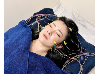 グリーン 京都店(green)/美容鍼で通電中