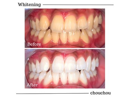 シュシュ(chouchou)の写真
