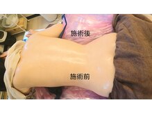 ヨリーズサロン 渡辺通(yoris.salon)の雰囲気（リンパを流すインドマッサージのテクニックで憧れクビレも★）