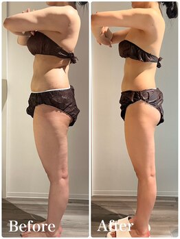 リッシュボーテ(RICHE BEAUTE)/【広尾/リンパマッサージ/痩身】