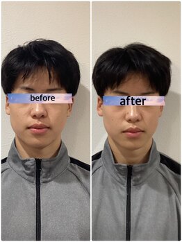 アンベリィ(Embellir)/骨格小顔矯正