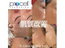 クレア(crea)の雰囲気（#プロセルセラピーズ【肌のお悩み改善】）