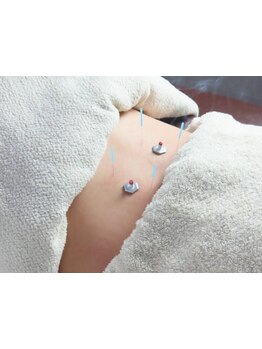 鍼灸施術を受けたい