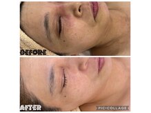 リンダ(Rinda)の雰囲気（JR尼崎で唯一の肌質改善クリスティーナ5ライン!ハーブリプロ!）