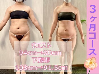 ラヴィアンローズ 津島店(La vie en Rose)/ビフォーアフター