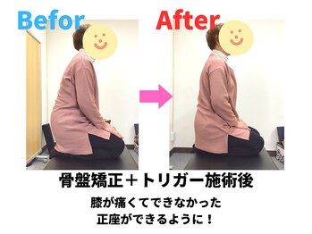 ナオル整体 勝田台院(NAORU整体)/骨盤矯正ビフォーアフター