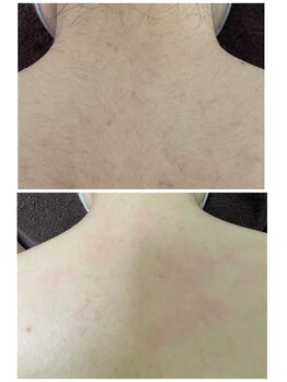 エン(en.)/BeforeAfter写真10