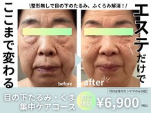 カリスボーテ 関本店の雰囲気（整形しなくてもカリスならここまで変われる！まずはご相談下さい）