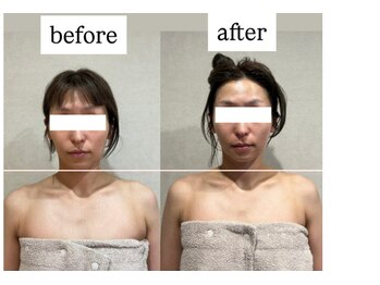 シェリーナ(cherieNa)/小顔×左右ゆがみも整う小顔矯正