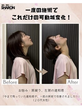 トゥーアズ シャロン(toAZ SHARON)/【鍼灸/肩こり】