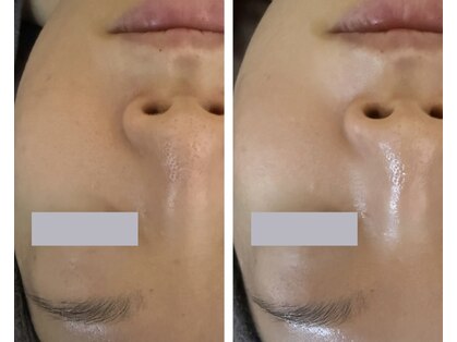 シロ(CHILO)の写真