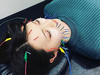 ツナギ美容鍼灸 整体院 宇都宮院(TSUNAGI美容鍼灸 整体院)の写真/【鍼灸施術が初めての方も不安なく♪】美容鍼で慢性的な肌悩みに徹底アプローチ！お子様連れOK♪