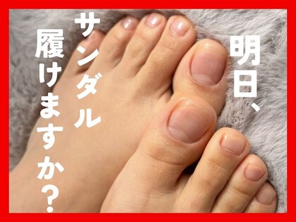 爪のいろはの写真