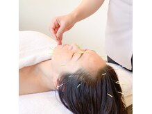 恵明堂の雰囲気（美容鍼もあります◎リンパマッサージ/肩こり/腰痛/美容鍼/一宮）