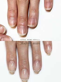 マリーロール 梅田店(Marie Laure)/自爪育成/深爪矯正/ネイルケア