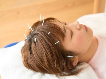 トーリ 代官山(taulli)/頭皮鍼【代官山/鍼灸】