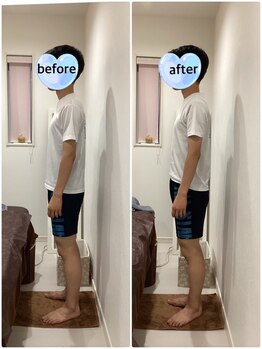 アンベリィ(Embellir)/全身美容矯正spフェムケア