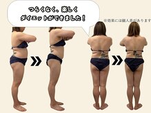 エルソル(elsol)/