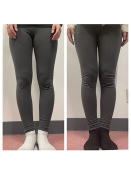 いわき美容整体院/O脚矯正