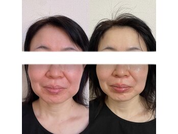 あいここ/お客様ビフォーアフター