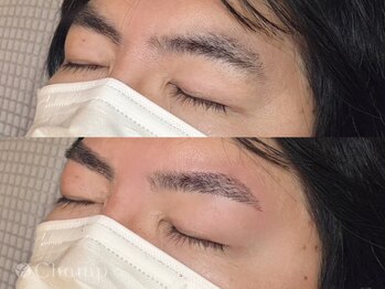 チャンプ 花園店(Champ)/メンズWAX脱毛