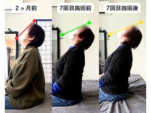整体院 爽良/【札幌/大通り】肩こりスッキリ