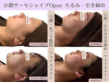 ラエッセ(La Esse)の写真