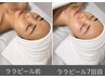 韓国美肌管理No.1 ララピール ¥15000→¥11000