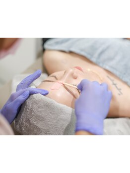 顔脱毛がしたい