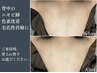 【ボディ人気NO.1】背中ハーフ　剥離ハーブピーリング  通常¥15,000