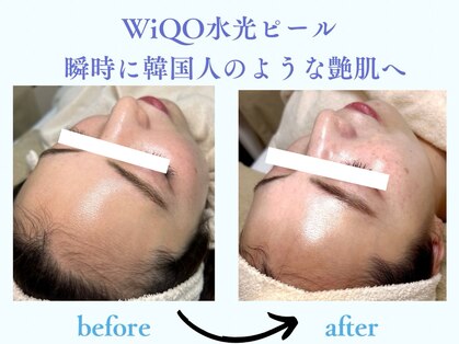 アンジェーム(angeame)の写真
