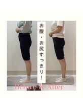 スタイルラボ高松/産後の骨盤矯正の効果♪