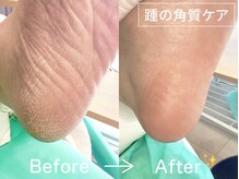 ディオフット(DIO FOOT)の雰囲気（お子様やご高齢者様も大歓迎◎信頼安心のフットケアで再発も防止）
