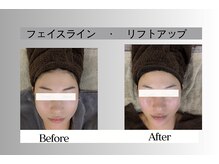 フェイシャルサロン セレスタイト/顔の輪郭、スッキリ実感